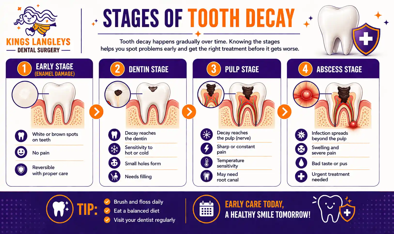 Stages of Tooth Decay