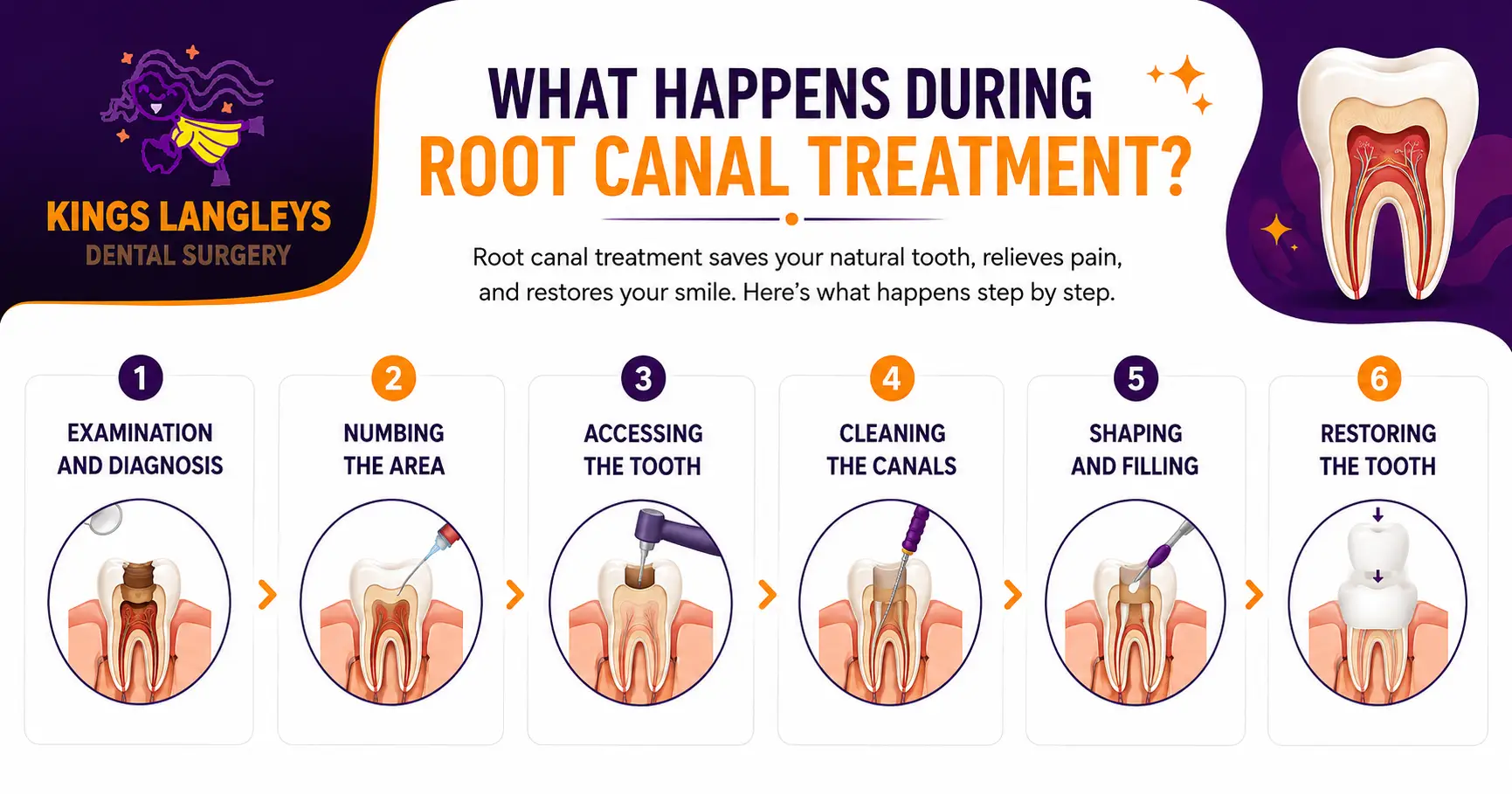 What Happens During Root Canal Treatment?