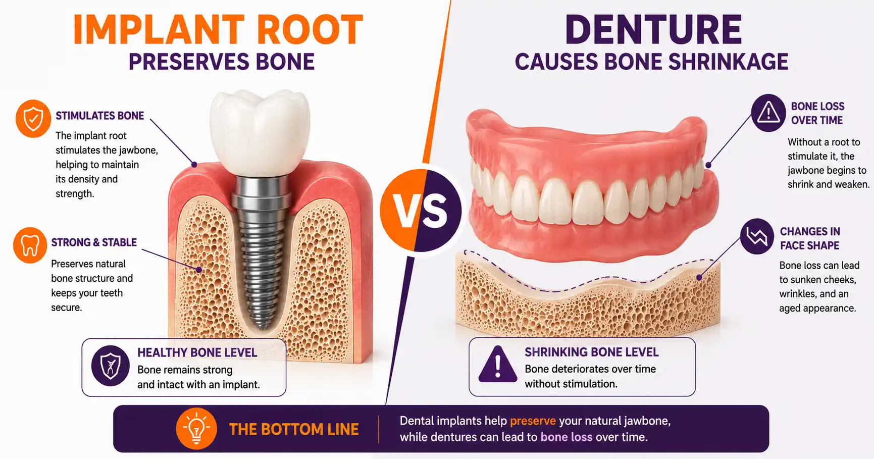 Dental implants vs dentures effect on jawbone