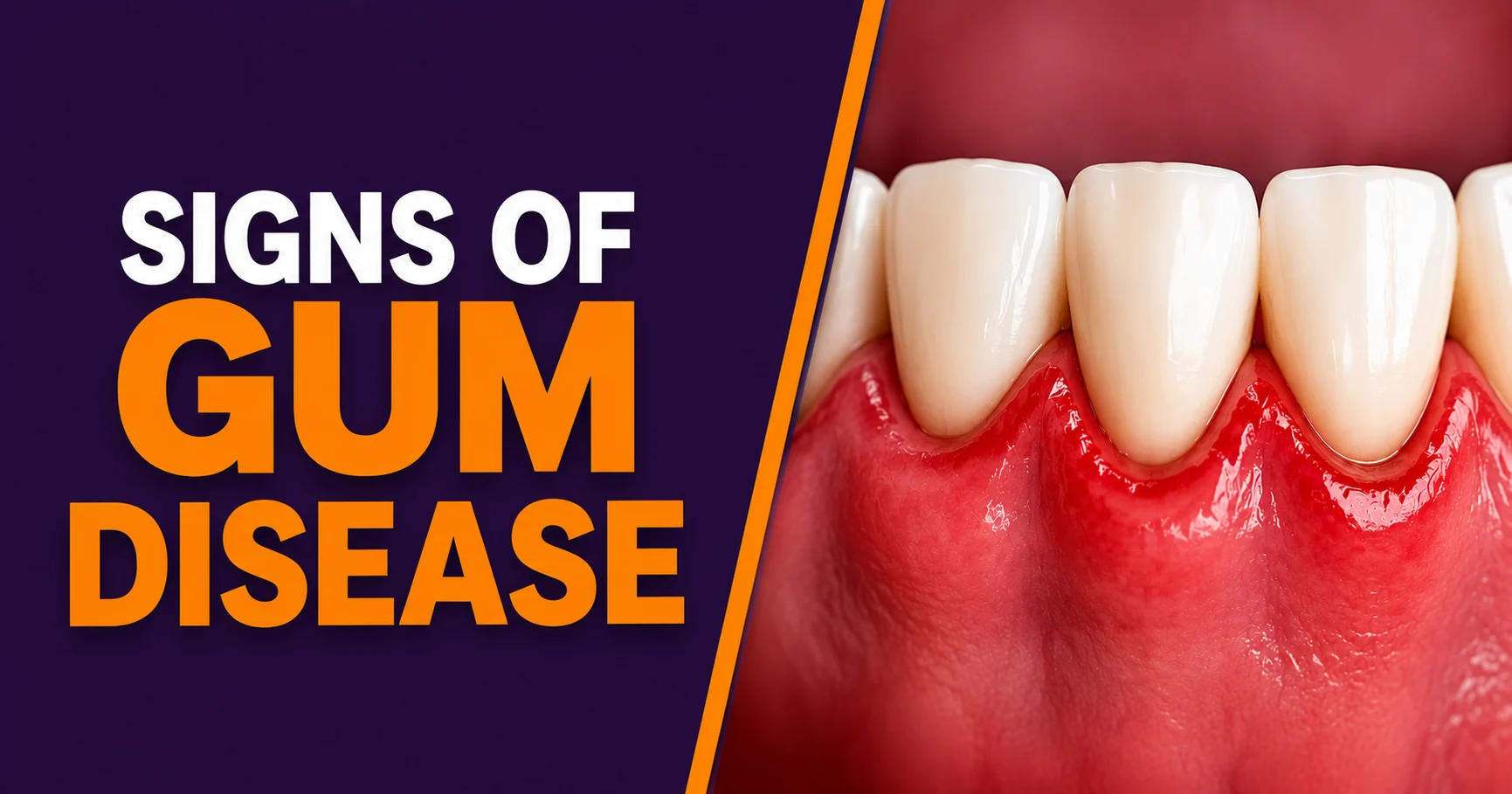 Signs of gum disease healthy vs inflamed gums