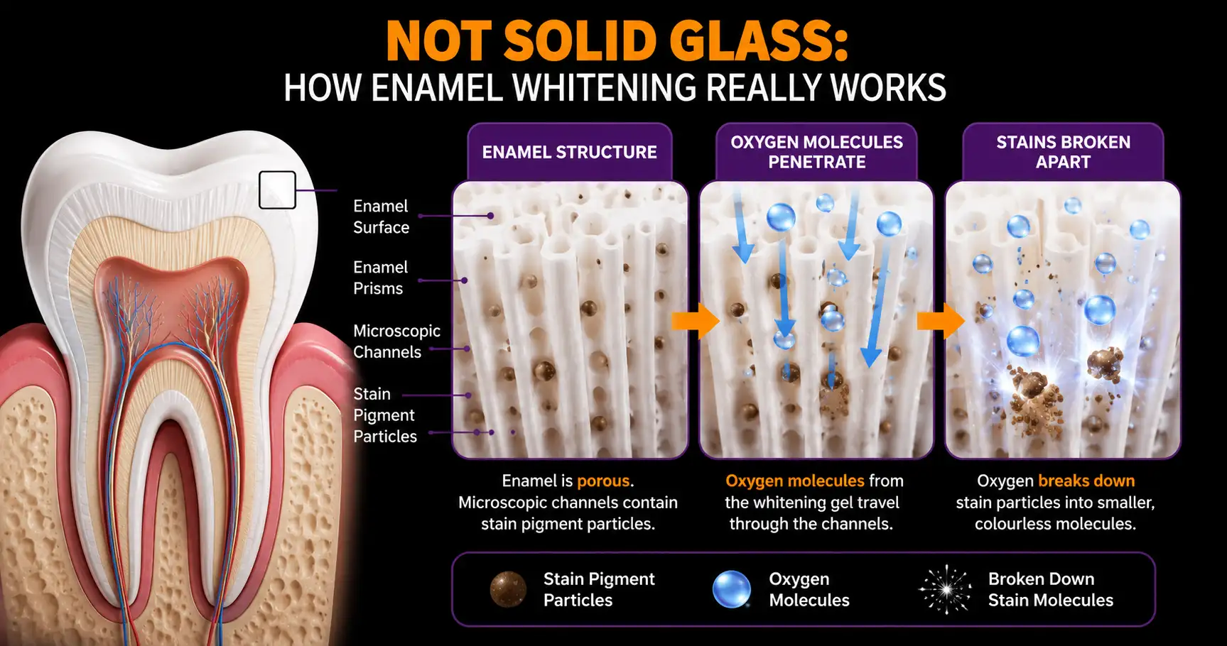 Diagram showing how whitening gel breaks down stain molecules inside tooth enamel.