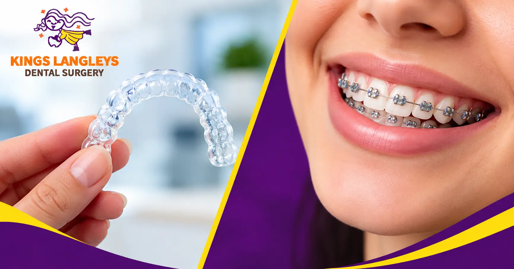Invisalign vs braces comparison