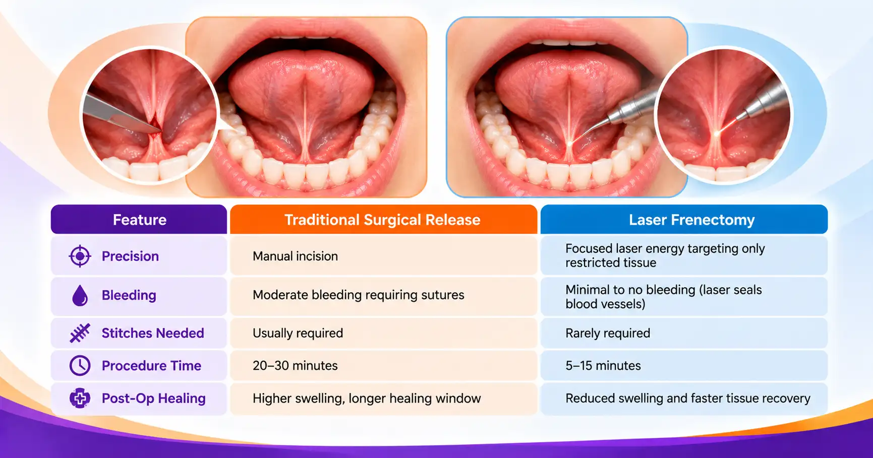 Modern Laser Frenectomy vs. Traditional Surgery